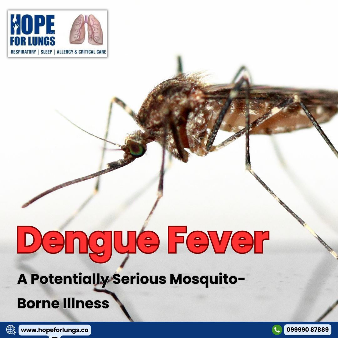 Dengue fever